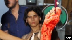 دغه تن د شام په لانجمنه سیمه لیپو کښې د شام حکومتی ځواکونو په ډزو کښې ژوبل شوې چی اوس یی په یو ځایی هسپتال کښې علاج روان دې.